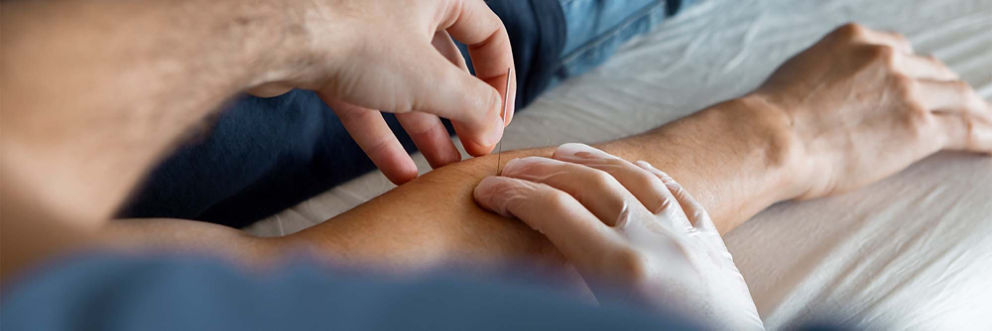 An acupuncturist places an acupuncture needle in a patient's arm.