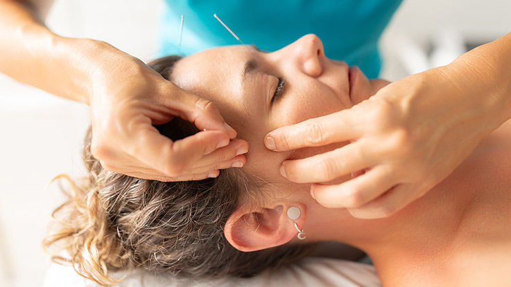 A clinician performs dry needling on a patient's head.